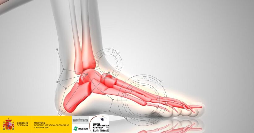 Entrenamiento robótico en la rehabilitación del tobillo para pacientes con ictus con pie caído: optimización de la intensidad y la frecuencia