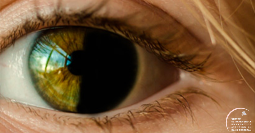 Velocidad de procesamiento visual de hemianopsia en pacientes con Daño Cerebral Adquirido.